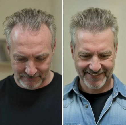 HairGuard густе волосся